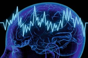 Healthcare-Science-Neurophysiology