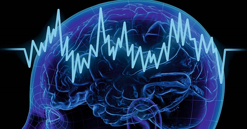 Healthcare-Science-Neurophysiology